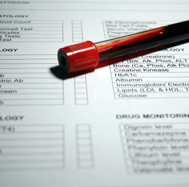 lab order and blood test