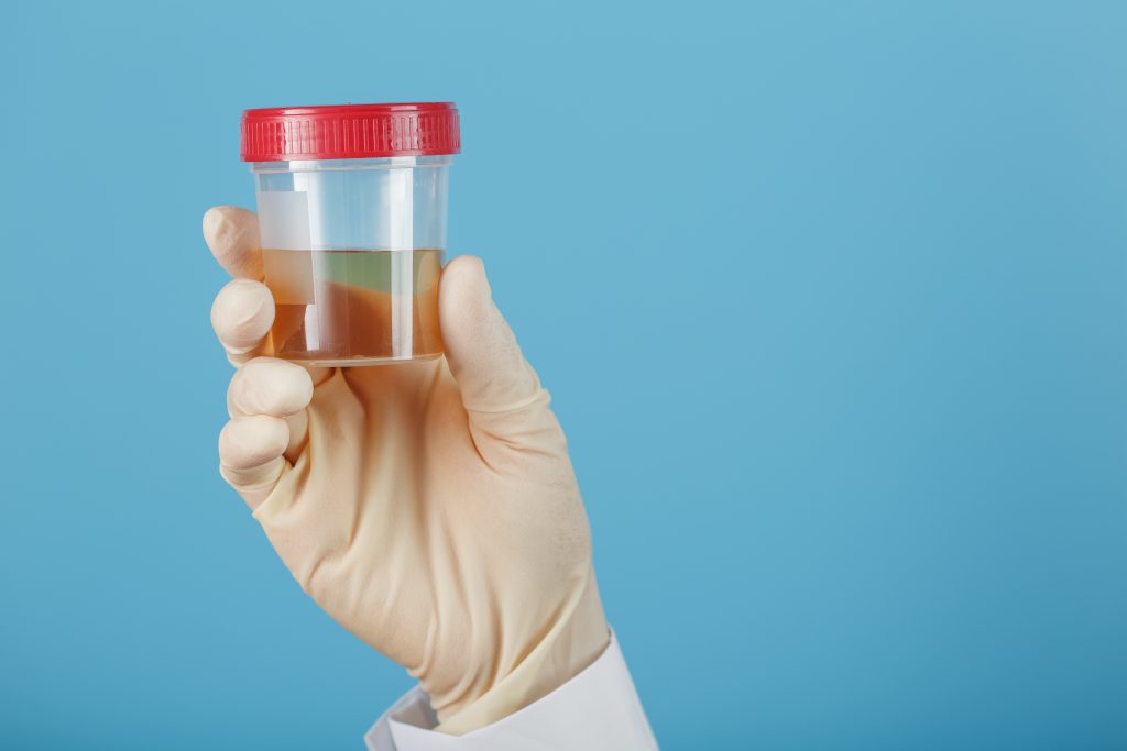 Medical assistant holding up urine specimen preparing it to be tested.