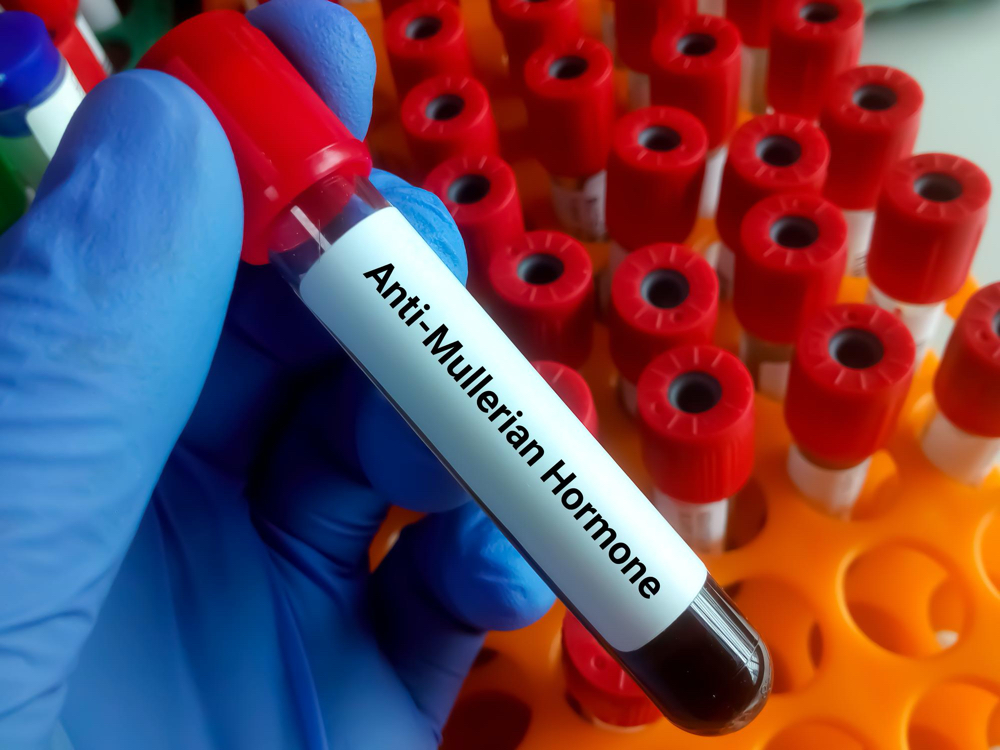 Anti mullerian hormone or amh test